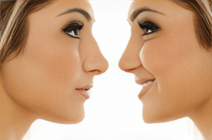 A woman considering revision rhinoplasty in Dallas, TX, holding a mirror reflecting her improved appearance after the procedure