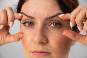 Woman holding eyelids up before blepharoplasty in Dallas, TX